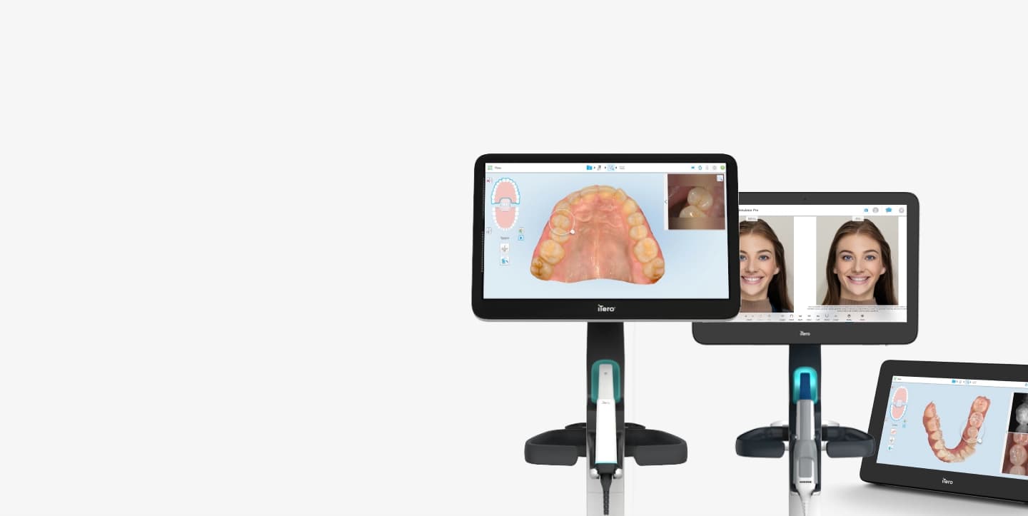 What is a 3D digital Scanner?