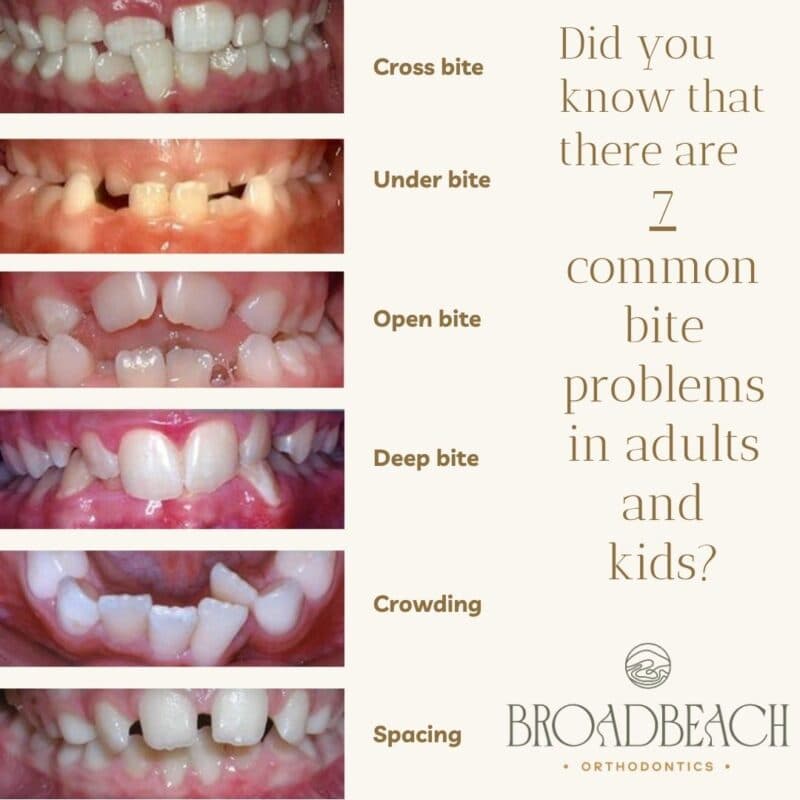 7 Common bite problems chart