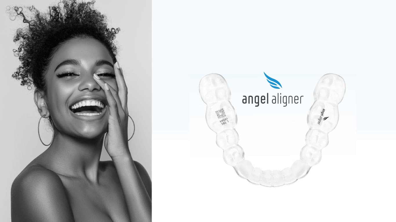 Angel Aligner clear aligner