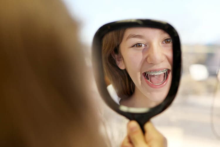 Can braces Make Your Teeth Fall Out or Loose?