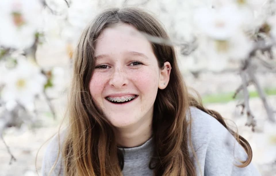 What parents need to know about braces for teenagers