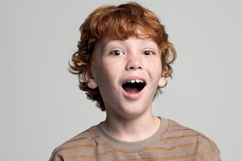 Why your child’s malocclusion should be treated?