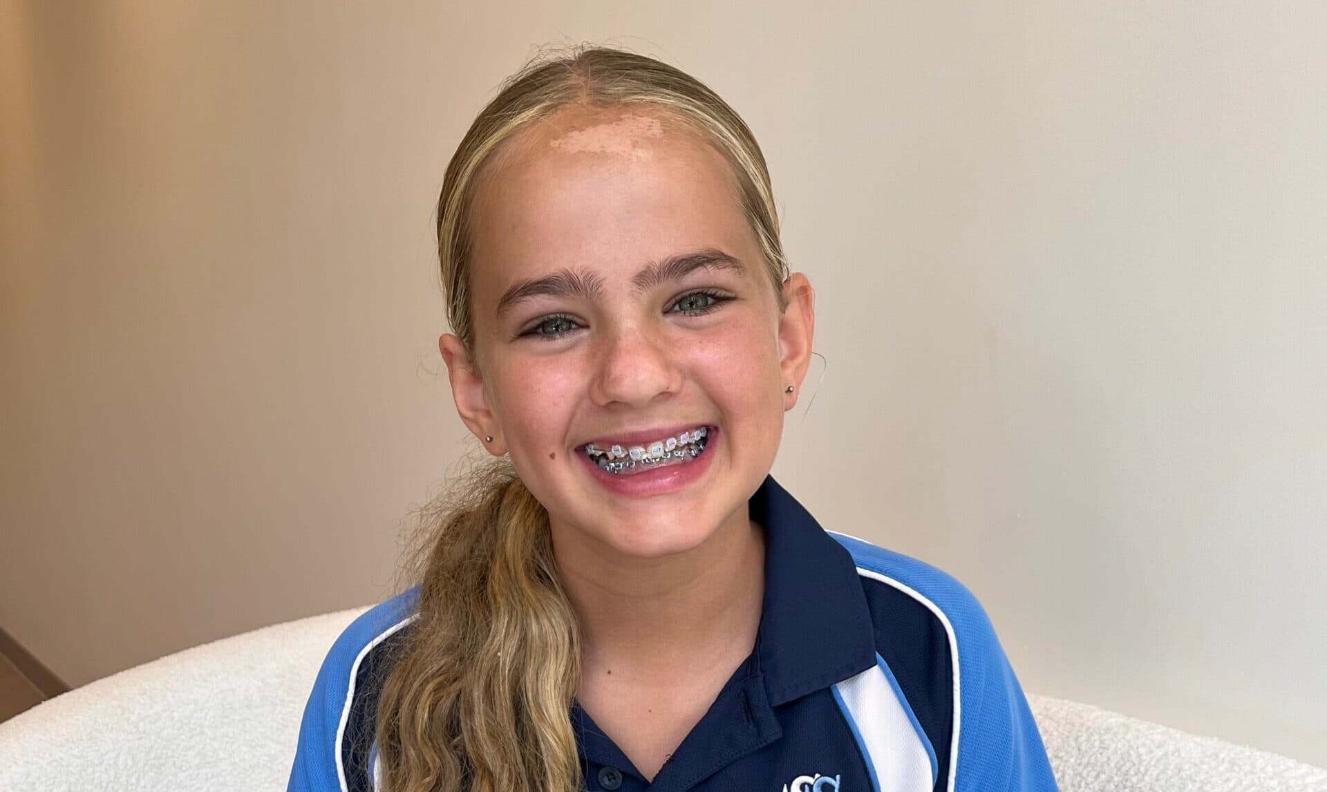 Same Day Braces on the Gold Coast at Broadbeach Orthodontics
