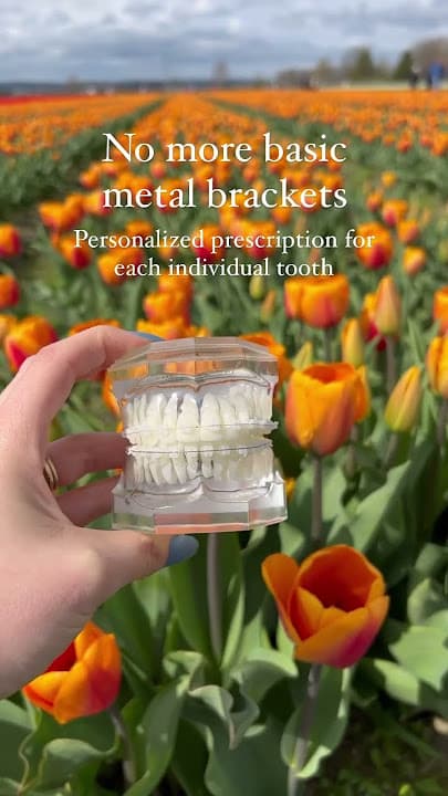 Braces Colours: Choosing The Right One