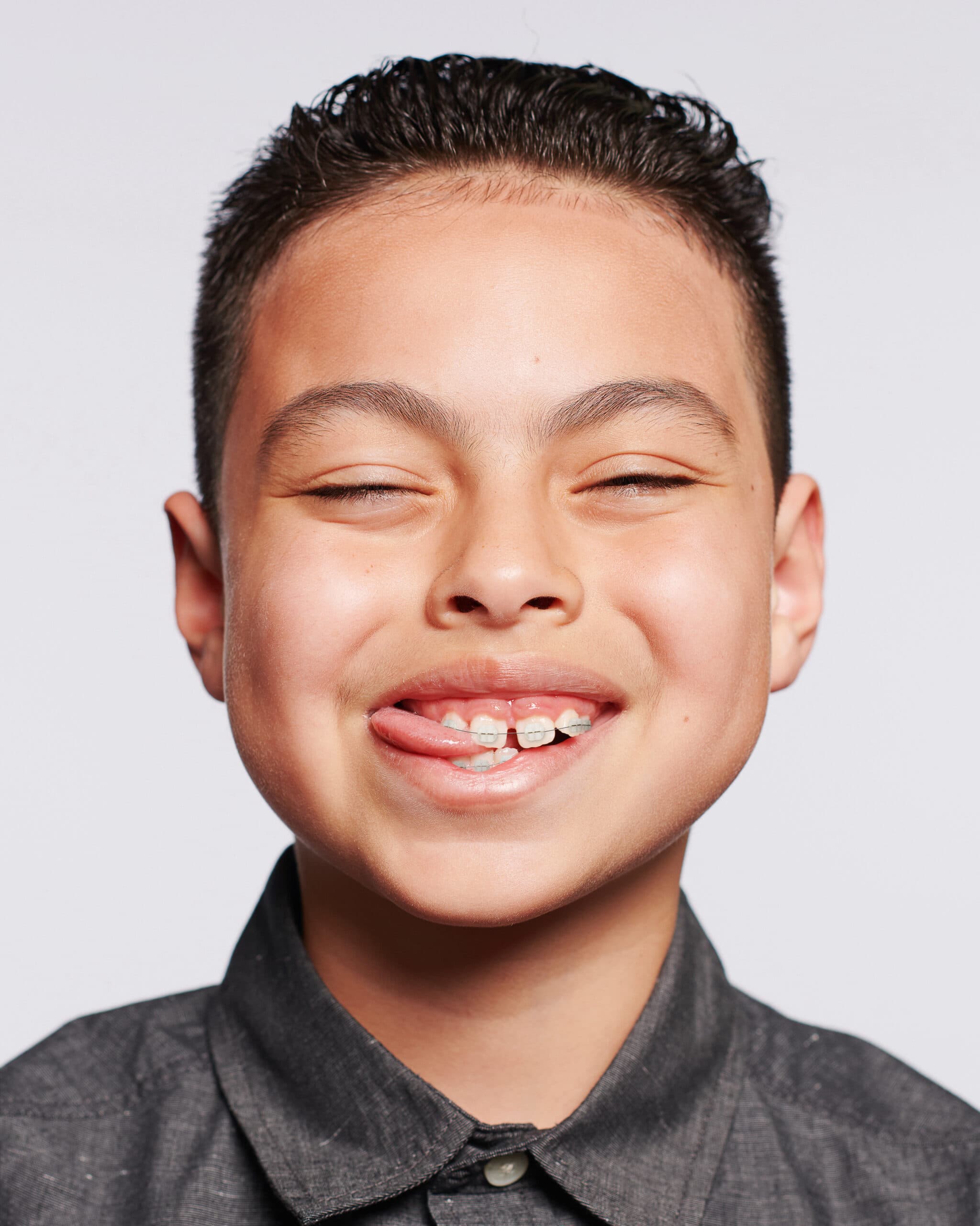 What to Expect on the First Day of Braces