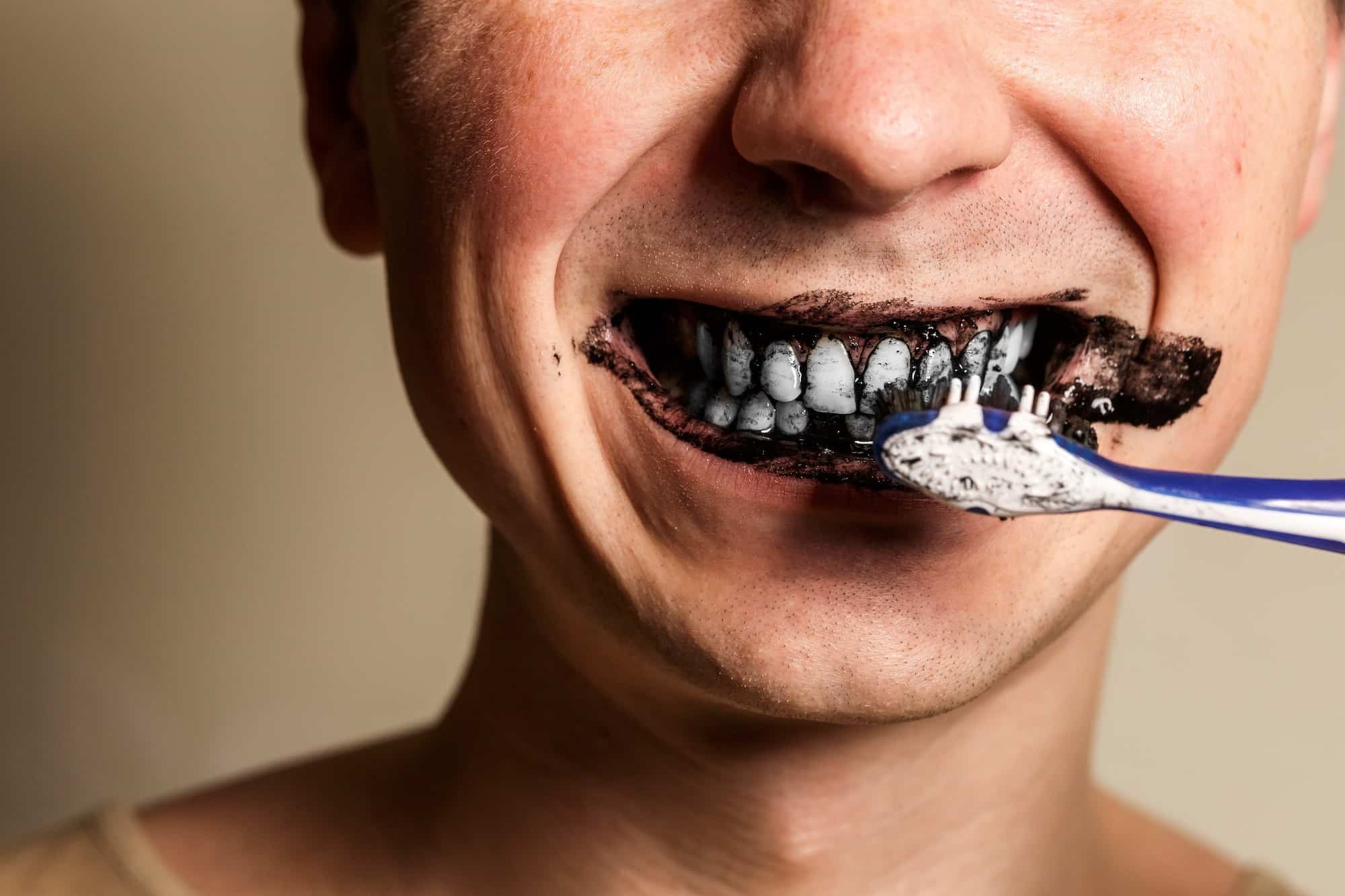 Is charcoal toothpaste good for whitening?