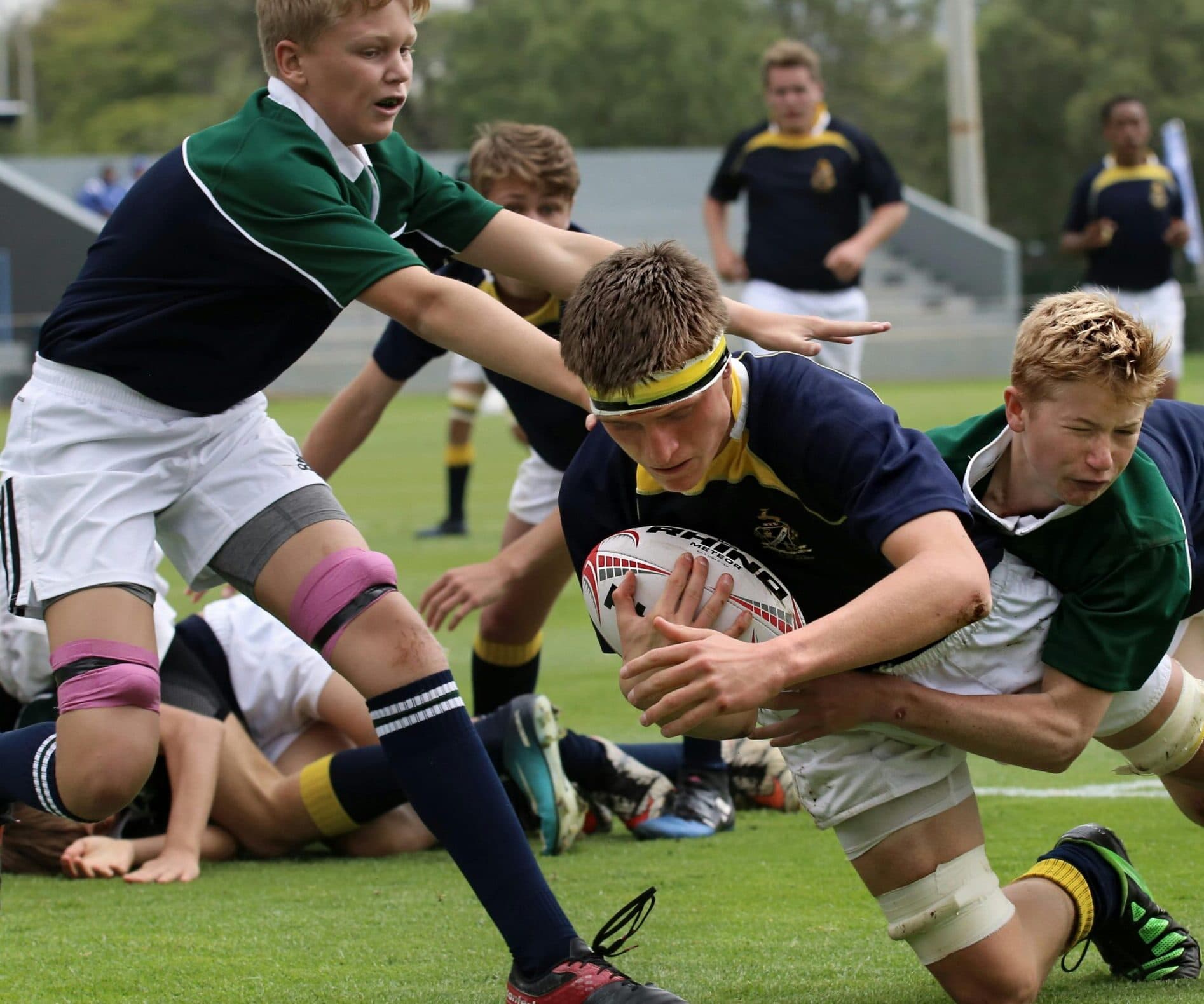 Do you need a mouthguard for braces or aligners?