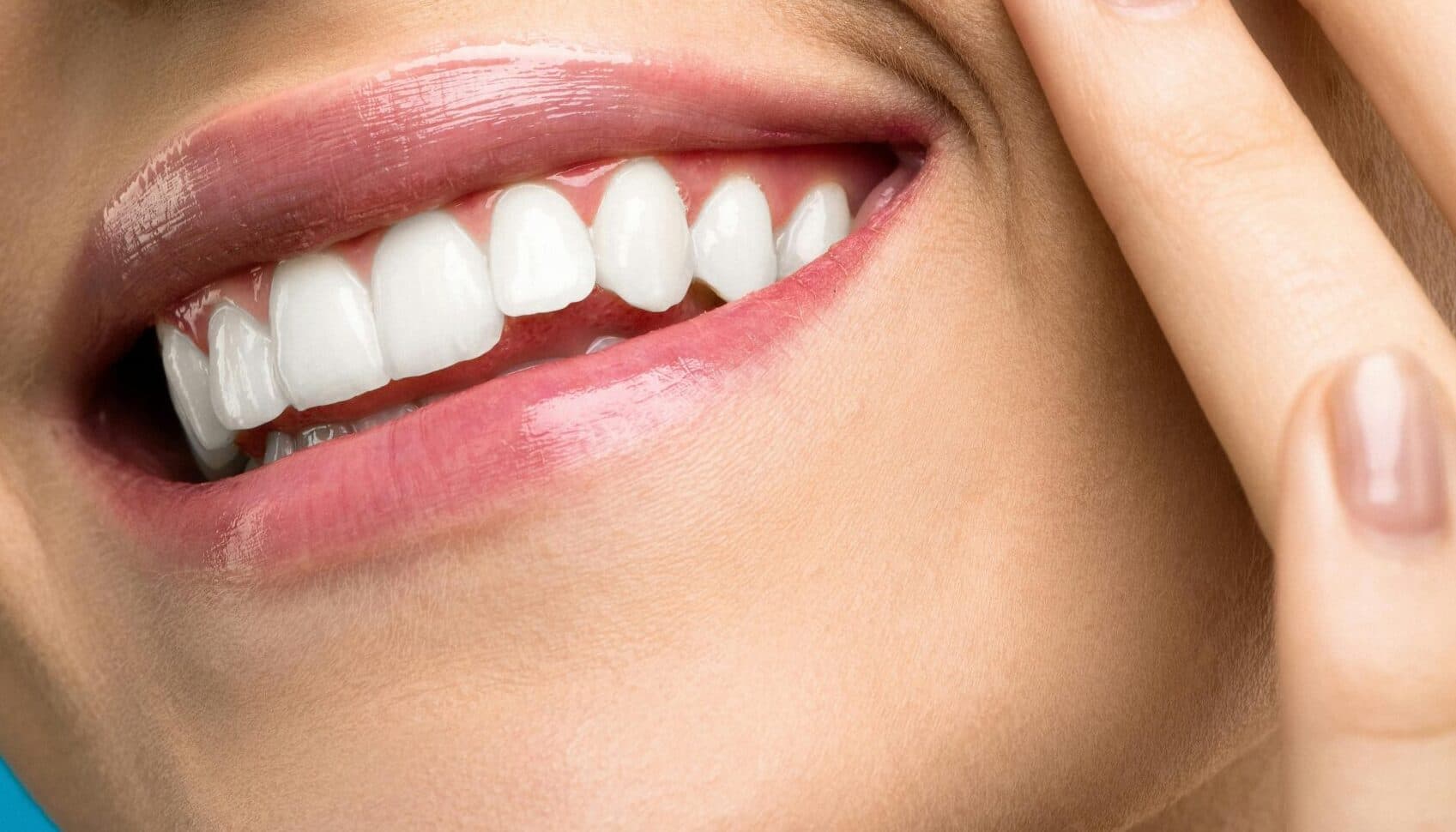 Professional teeth whitening with Pola in Broadbeach