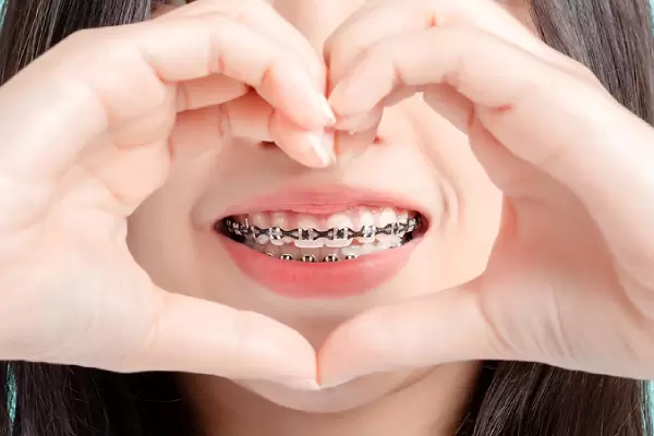 Can I straighten my teeth with Metal braces?