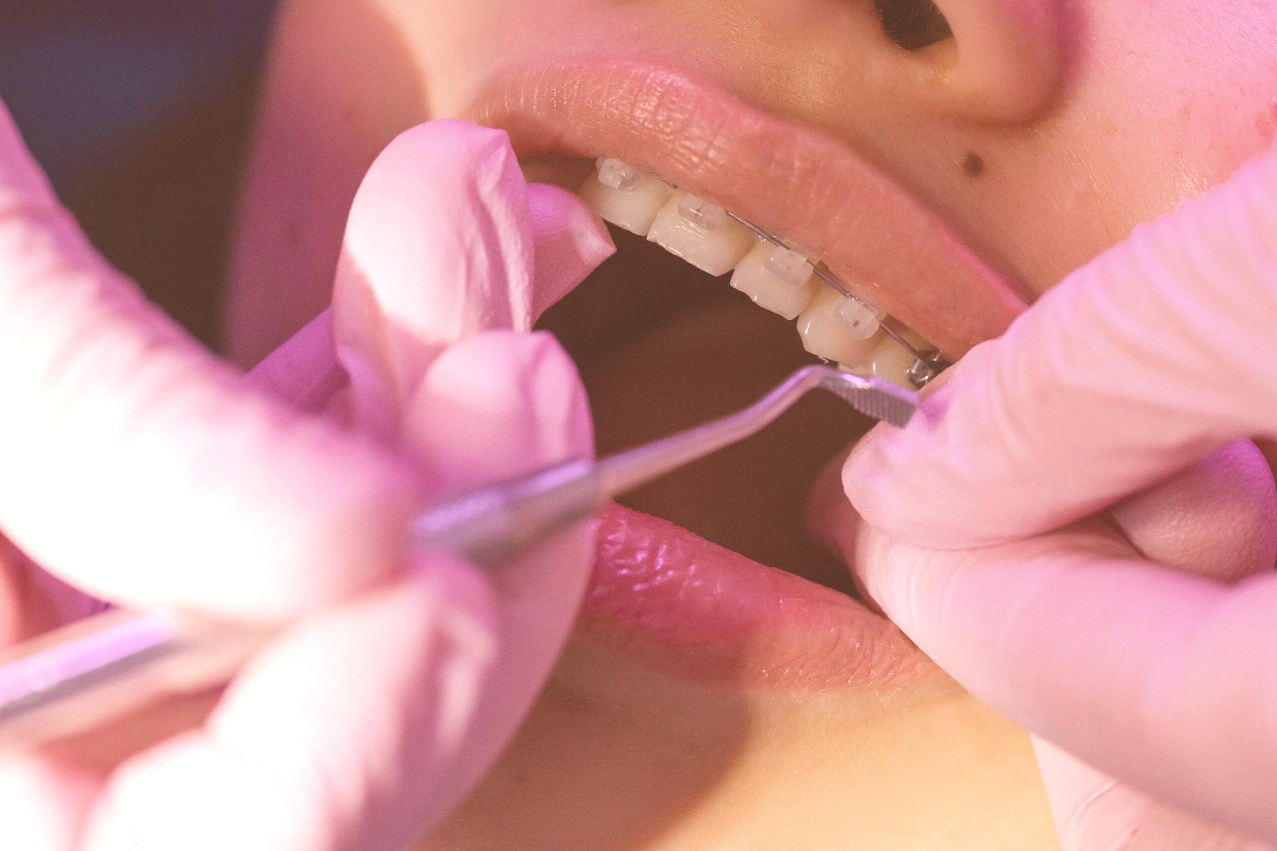 Dentist or Orthodontist for your teeth straightening needs?